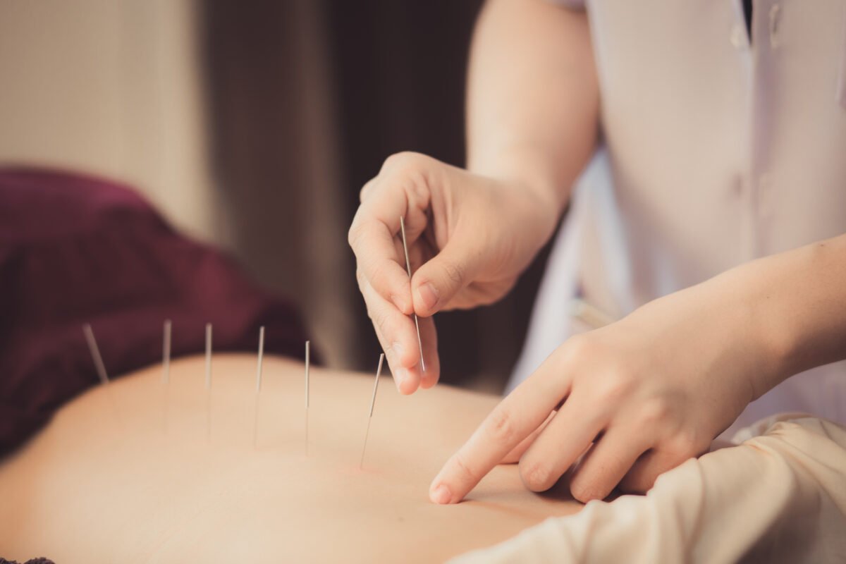 Acupuncture Improves Outcomes for Dialysis Patients: Study