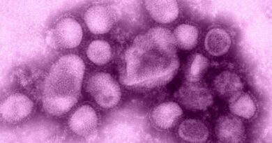 1st Human Case of Swine Flu Variant Detected as Officials Scramble to Find Contacts
