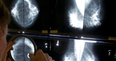 Breast Cancer Screening Should Start at Age 40, Canadian Cancer Society Says