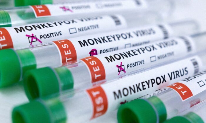New York Officials Warn of Monkeypox Surge After Sounding Alarm on Deadly Disease Caused by Rat Urine